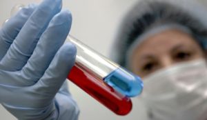 Количество ВИЧ-инфицированных в Крыму ежегодно увеличивается на 10%