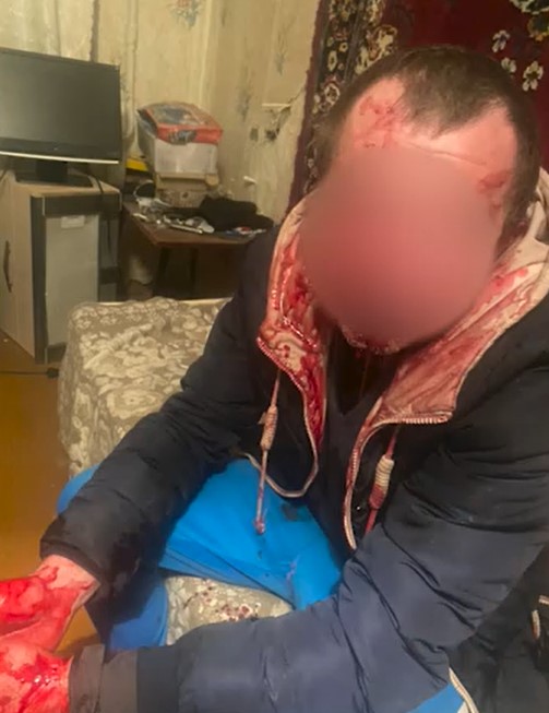 policiya zaderzanie noz1