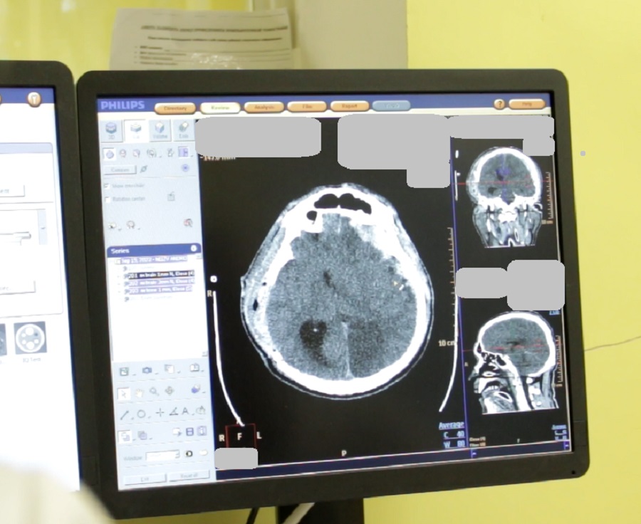 diagnosyika fmda